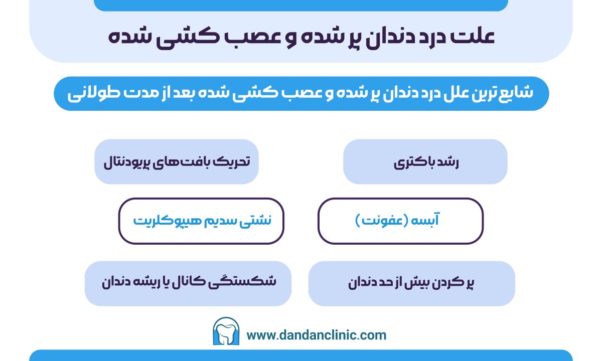 علت درد دندان پر شده و عصب کشی شده